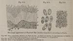 Fig. 212-214. Microscopic appearance of Ergotized ...