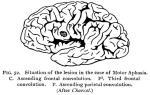 Figure 52. Situation of lesion