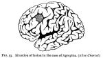 Figure 53. Situation of lesion