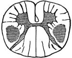 Figure 42. Position of lesion